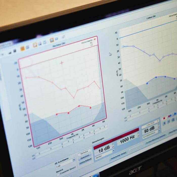 Mit der Perzentilanalyse holen wir das beste aus Ihren Hörgeräten heraus Das Programm der Perzentilanalyse